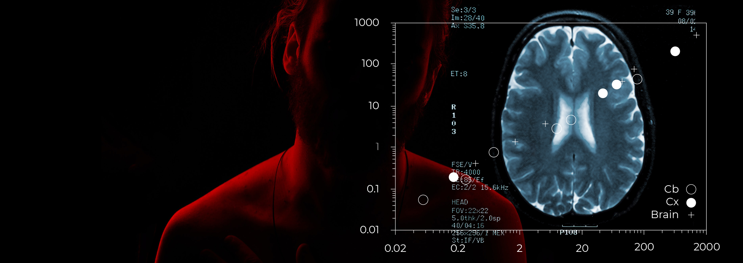 Master Mm Plus Bilder